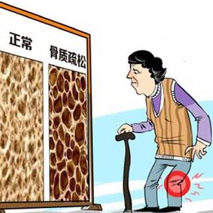 骨质疏松卡通3