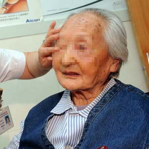 老年人白内障2