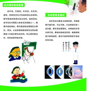 白内障宣传图2