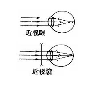 近视眼成像示意图3