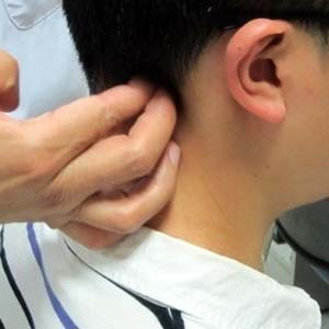 过敏性鼻炎按摩方法图7